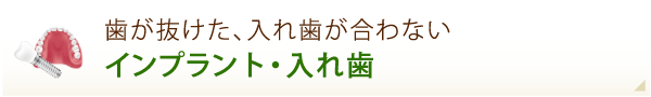 インプラント・入れ歯